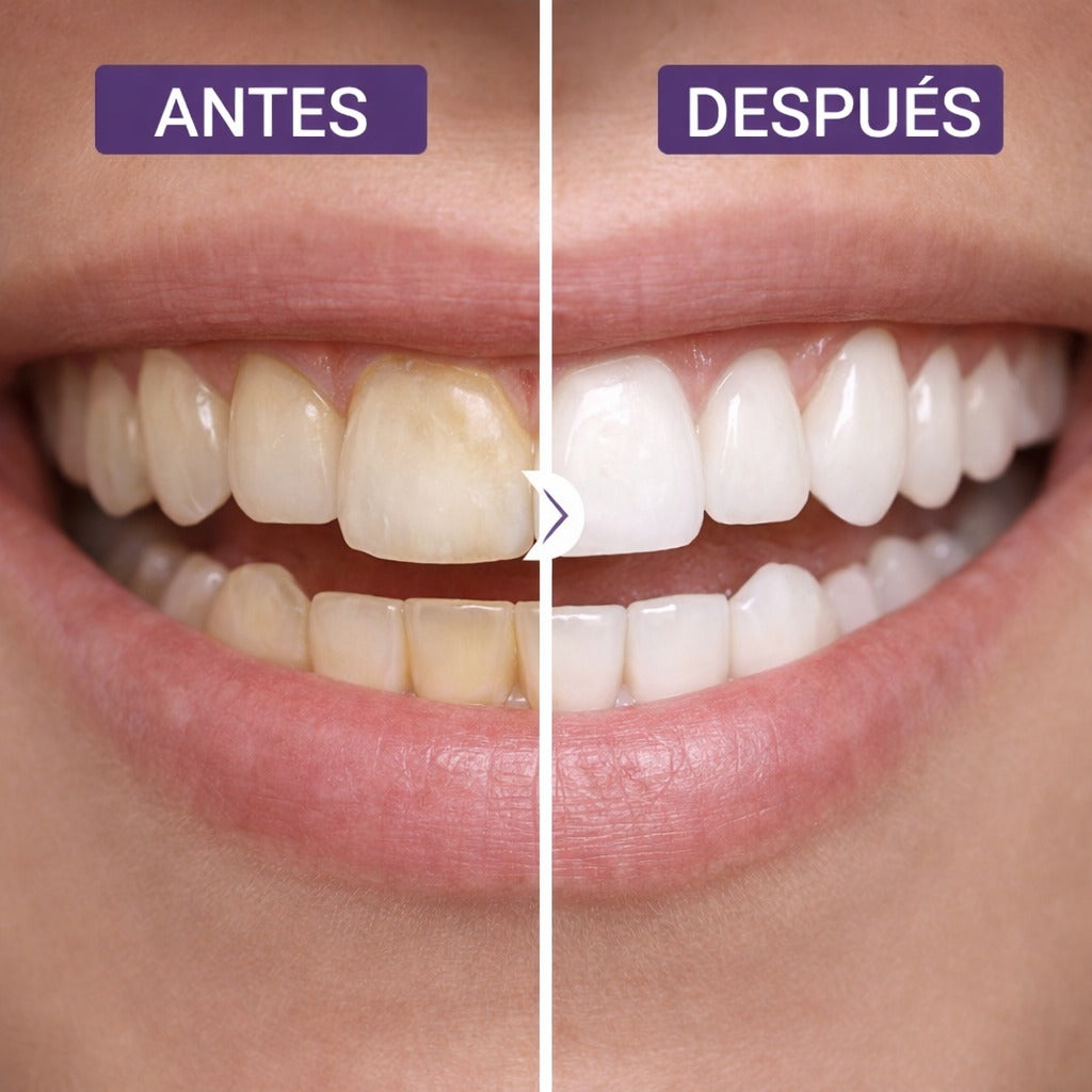 Blanqueador Dental Lila V34