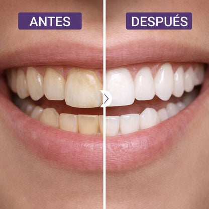 Blanqueador Dental Lila V34