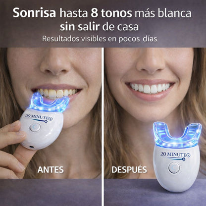 BLANQUEADOR DENTAL UV – KIT CON LUZ LED